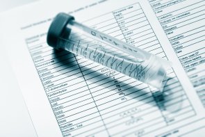 Wasser für Analyse Trinkwasser im Reagenzglas für chemische und mikrobiologische Analyse